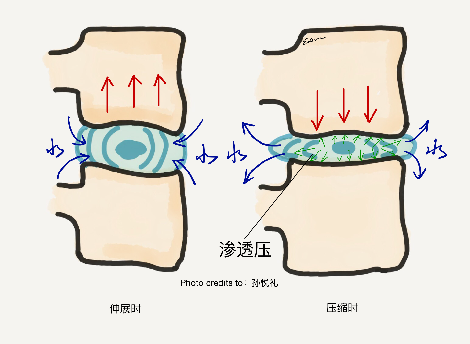 腰椎受力图解图片