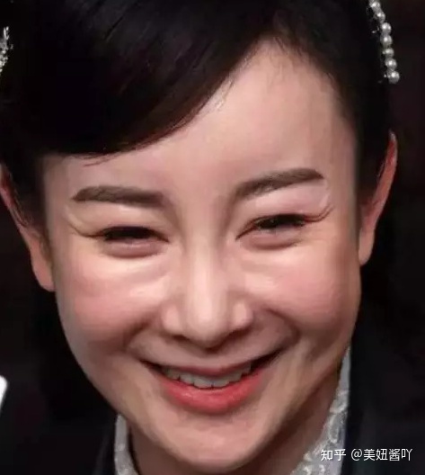 哪些明星的脸已经/快要崩了?