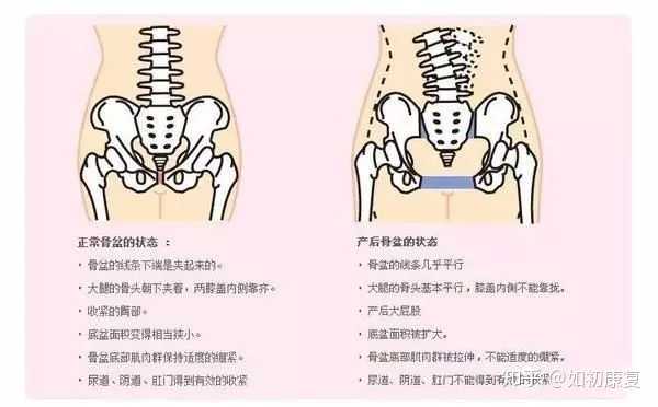 产后骨盆修复和盆底肌修复的区别