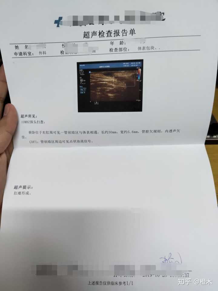 得了肛瘘是怎样一种体验