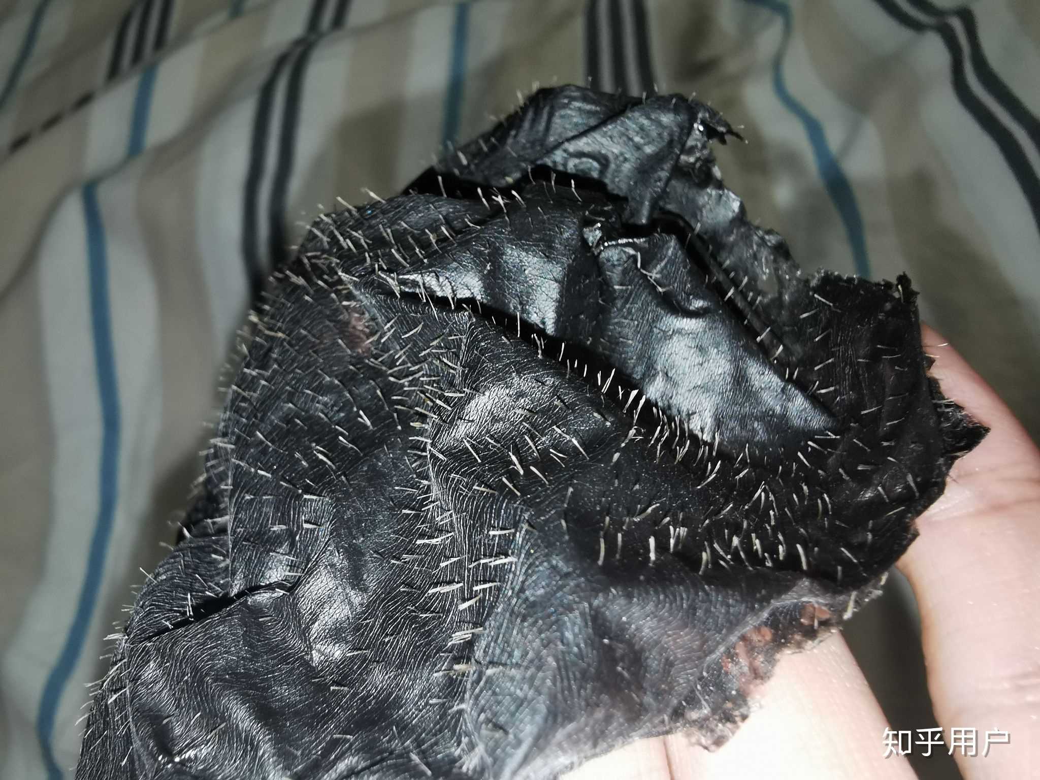 我背部毛孔粗大,而且好像有的毛孔里不止一根汗毛的样子,怎么办?