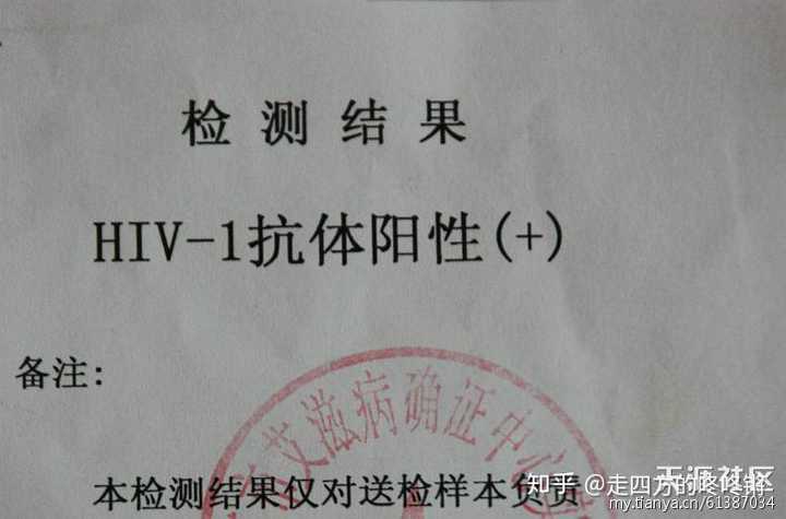 今天下午疾控中心看艾滋结果告诉我需要复查一周后等结果