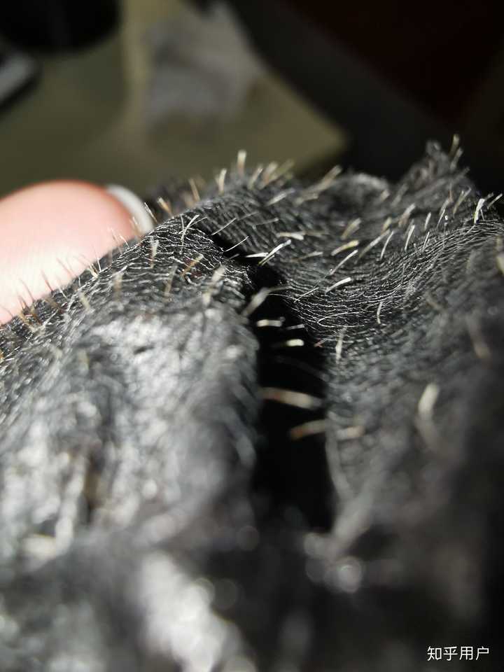 我背部毛孔粗大,而且好像有的毛孔里不止一根汗毛的样子,怎么办?